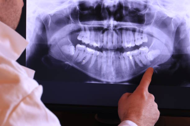 Best Emergency Dental Care for Broken or Chipped Teeth in Mante, CA
